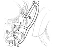 Honda VT 750 C2 [1997-2001] - motor protection bar-2